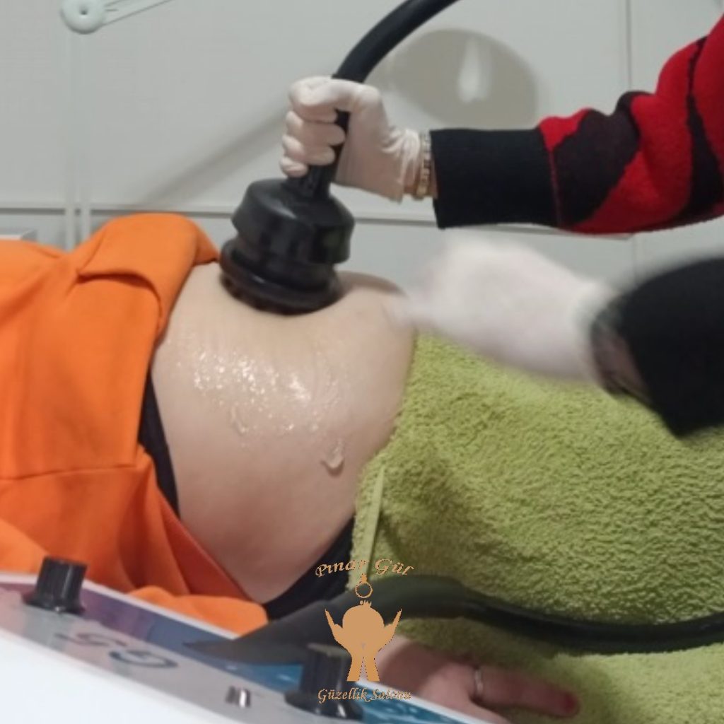 G5 bölgesel incelme yenikent güzellik salonu pınar gül