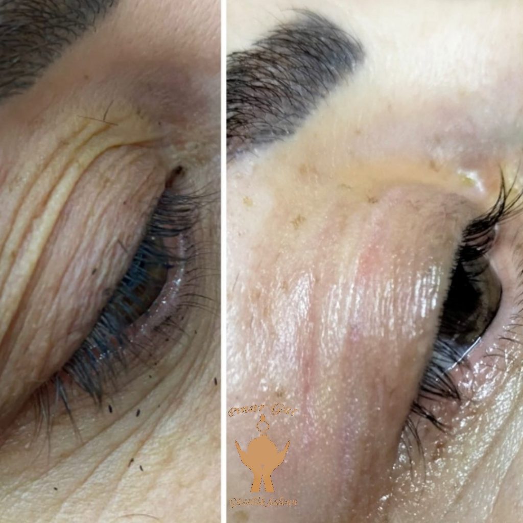 plazma pen yenikent güzellik salonu pınar gül